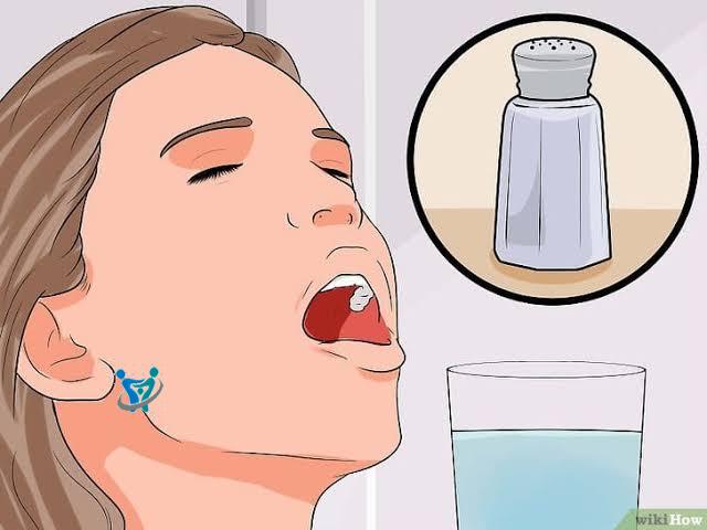 آلام الأسنان وعلاجها في المنزل 1 images 44